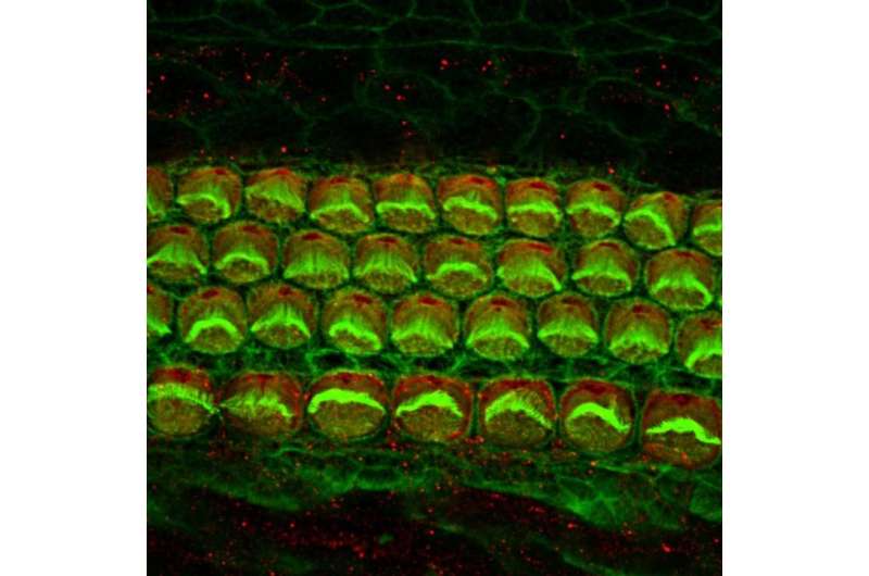 Mistakes in how proteins of the ear are built contribute to early hearing loss
