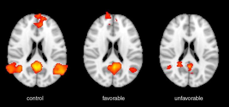 MRI may predict neurological outcomes for cardiac arrest survivors