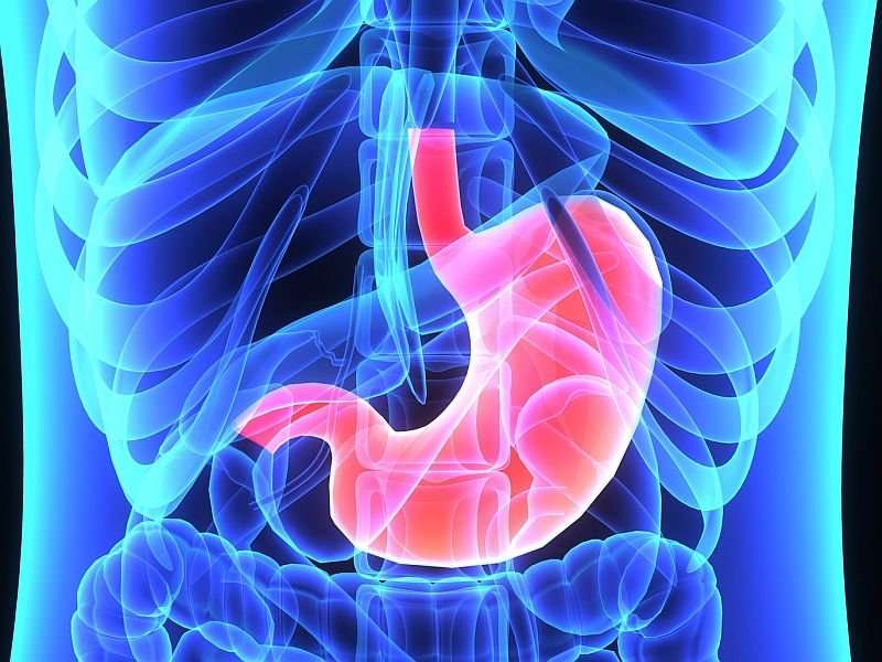 NAFLD not independently tied to risk of reflux esophagitis