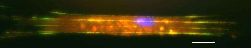Nanoscale forces measured in aortic smooth muscle cells tell story of disease