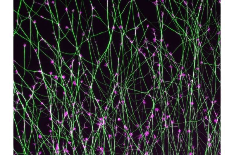 Navigation system of brain cells decoded