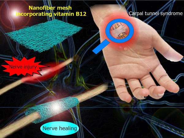 Nerve wrapping nanofiber mesh promoting regeneration