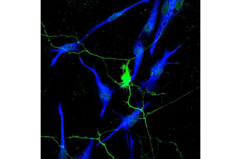 Neurons support cancer growth throughout the body