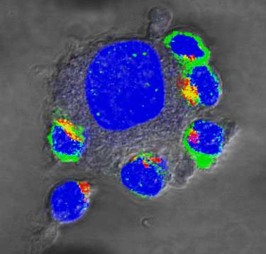 New approach in T-cell therapy to treat cancer