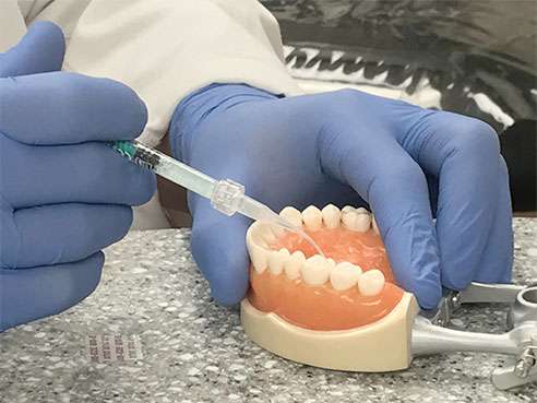 New cavity treatment offers no drilling, no filling