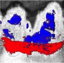 New dental imaging method uses squid ink to fish for gum disease