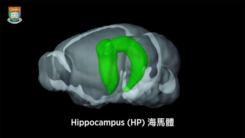 New functions of hippocampus unveiled to bring insights to causes and treatments of brain diseases