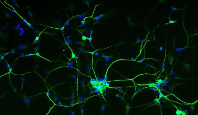 New genetic models of autism point to cellular roots of disease