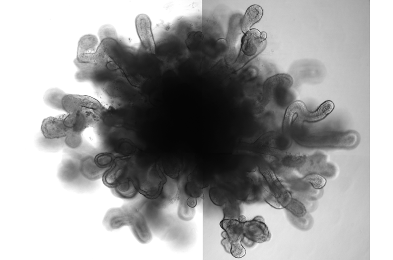 New lung 'organoids' in a dish mimic features of full-size lung