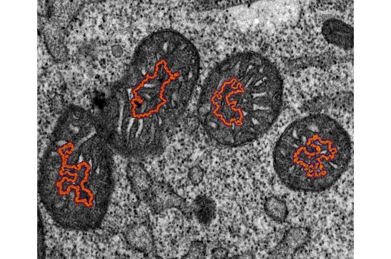 New online database has answers on mitochondrial disorders