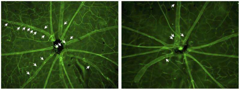 New RNAi treatment targets eye inflammation