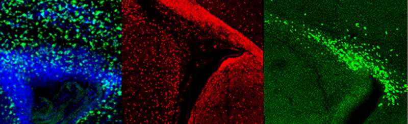 New strategy identifies potential drugs and targets for brain repair