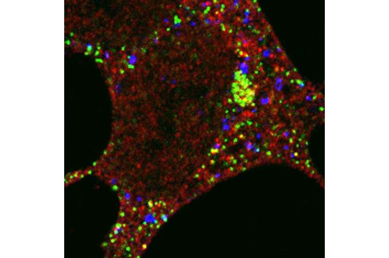 New study sheds light on disease-busting 'recycling bins' in our cells