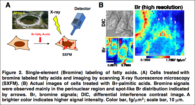 New way of visualizing fatty acids inside cells
