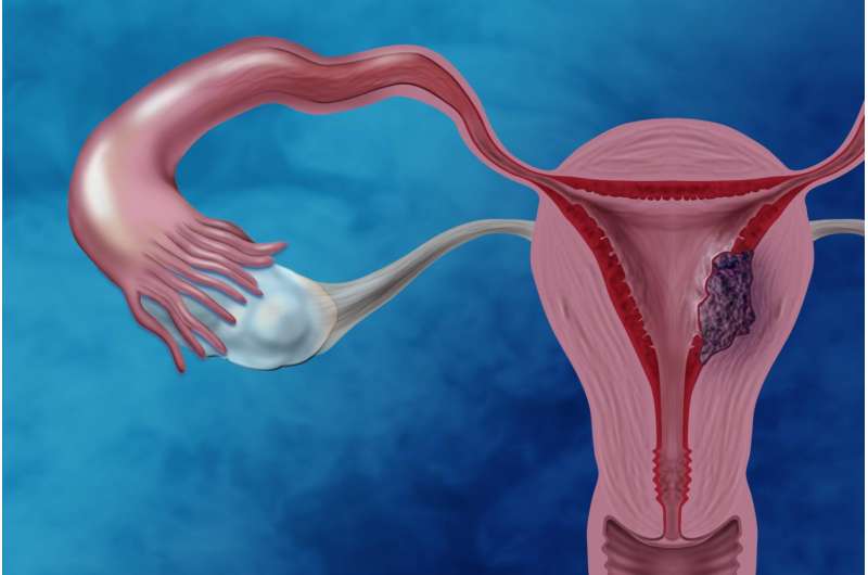 NHGRI researchers home in on mutation profiles of clear cell endometrial cancer
