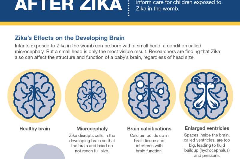 NIH workshop identifies complex health problems among Zika-affected infants