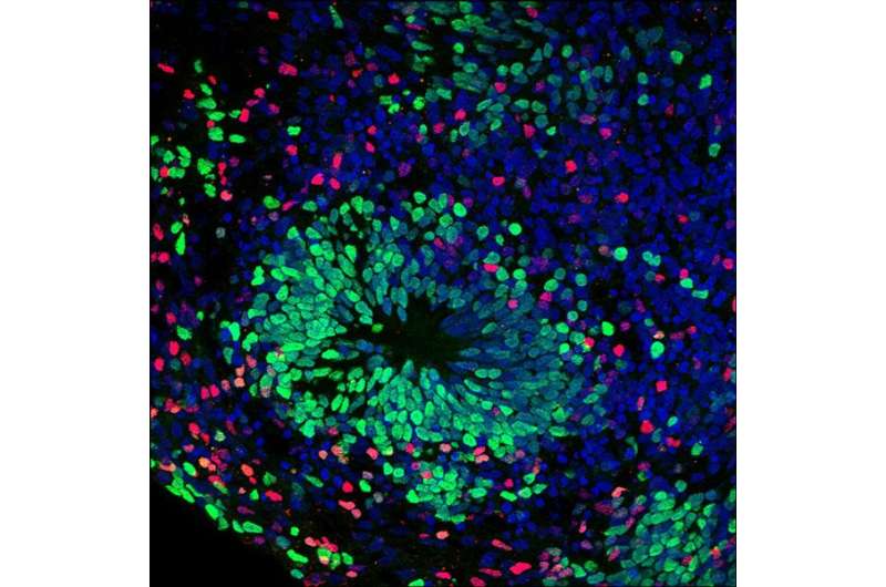 Novel stem cell-derived model created of inflammatory neurological disorder