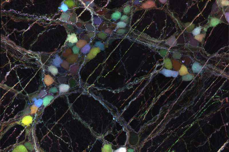Novel viral vectors deliver useful cargo to neurons throughout the brain and body