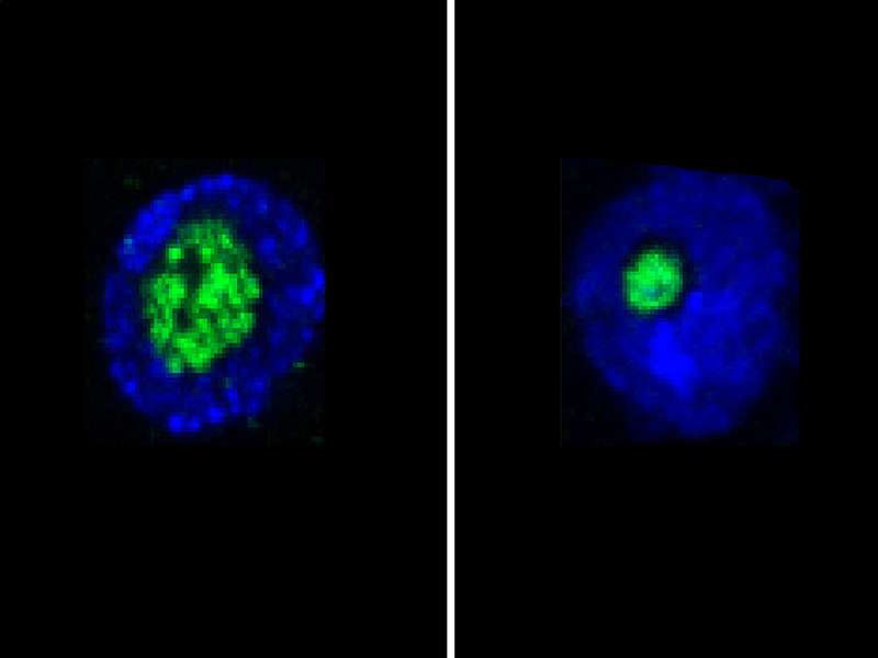 Nucleolus is a life expectancy predictor