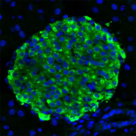 Pathways leading to beta cell division identified, may aid diabetes treatment