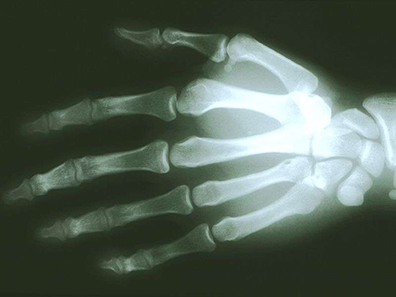 Patient involvement can cut errors in X-ray imaging