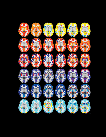 Penn study finds gray matter density increases during adolescence