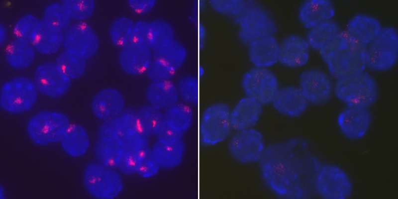 Penn study shows how female immune cells keep their second x chromosome shut off