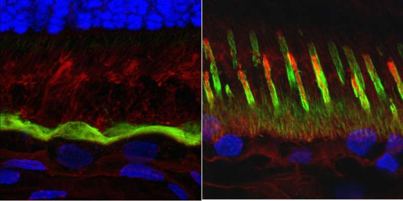 Penn team characterizes the underlying cause of a form of macular degeneration