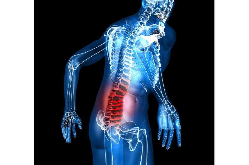Placebo and valium are equally effective for acute lower back pain in the ER