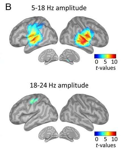 预测声音何时会发生依赖于大脑的运动系统