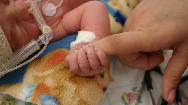 Preemies' dads more stressed than moms after NICU