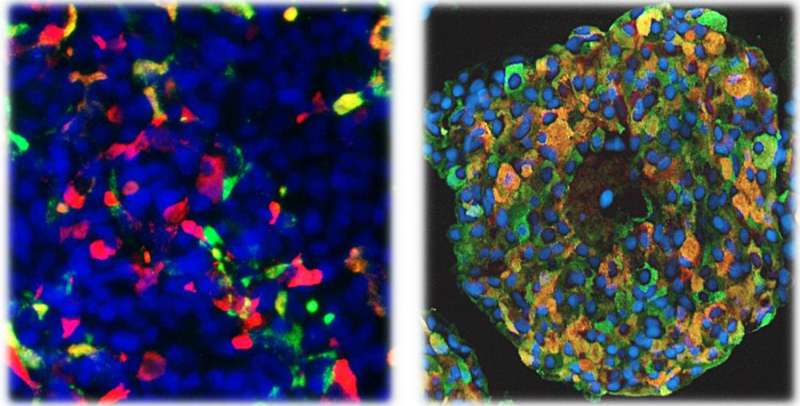 Premature cell differentiation leads to disorders in pancreatic development