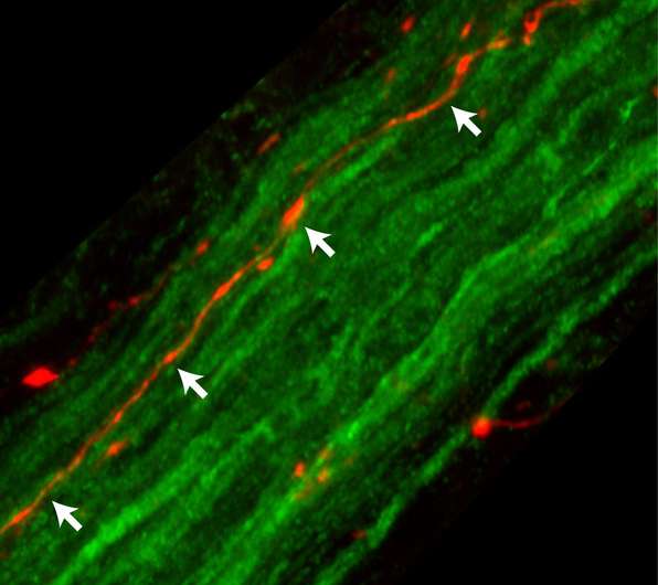 Protein associated with Parkinson's travels from brain to gut