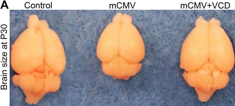 Psychiatric medication protects developing mouse brain from birth defects