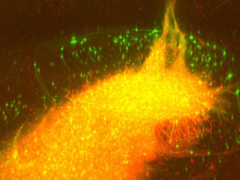 Rabies viruses reveal wiring in transparent brains