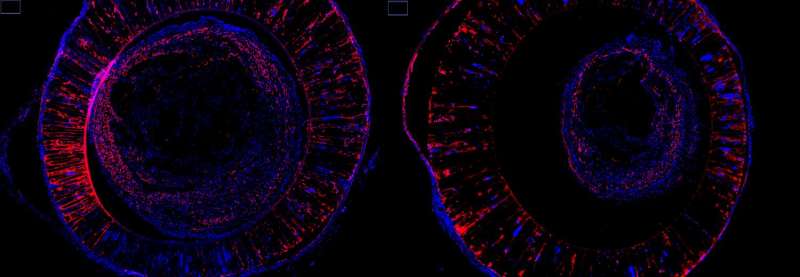 Regenerating damaged nerves with 'Pac-Man' cells