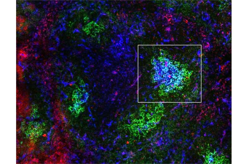 Research helps explain how B cell metabolism is controlled