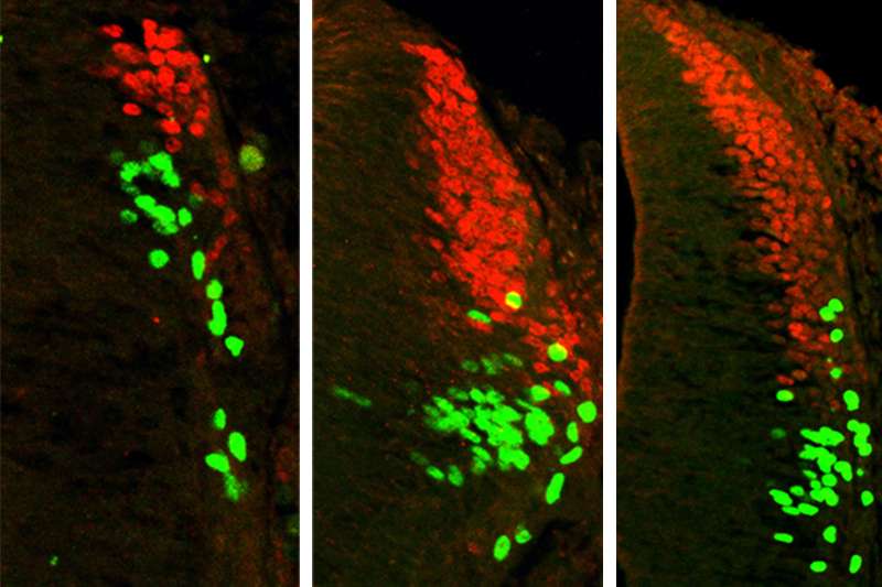Research redefines proteins' role in the development of spinal sensory cells