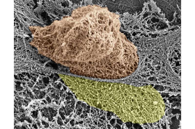 See how immune cells break through blood vessel walls