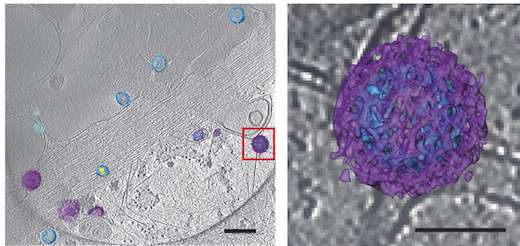 Seeing viruses by both light and electron microscopy