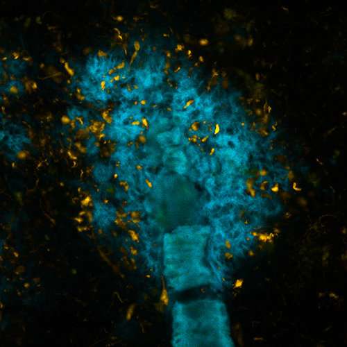 Shining molecules distinguish between proteins in the brain