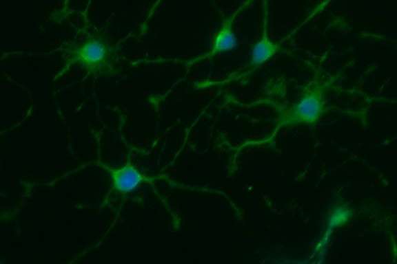 Sick stem cells point to better MS drugs