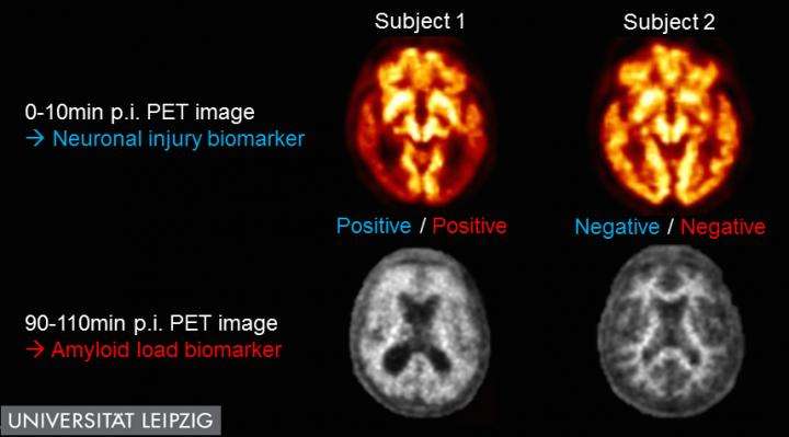 Single dual time-point PET scan identifies dual Alzheimer's biomarkers