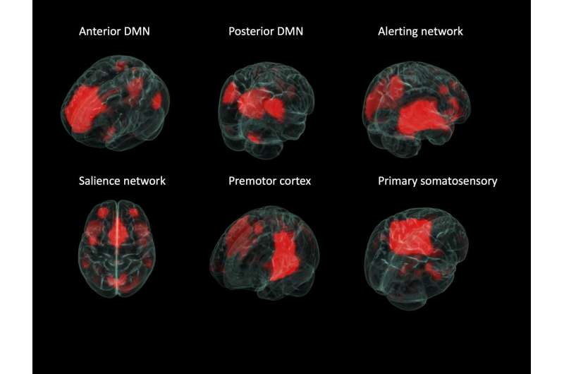 Statistics method shows networks differ in epileptic brains