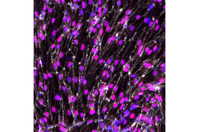 Stem cell advance brings bioengineered arteries closer to reality