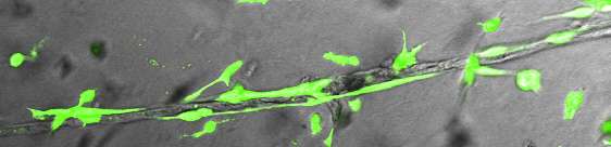 Stem cells yield nature's blueprint for body's vasculature