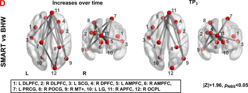 Strategic brain training positively affects neural connectivity for individuals with TBI