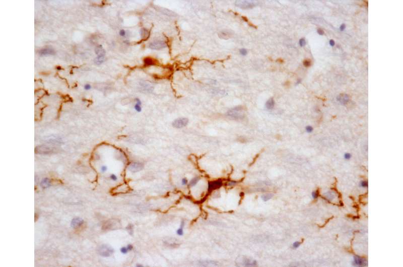 Study of nervous system cells can help to understand degenerative diseases