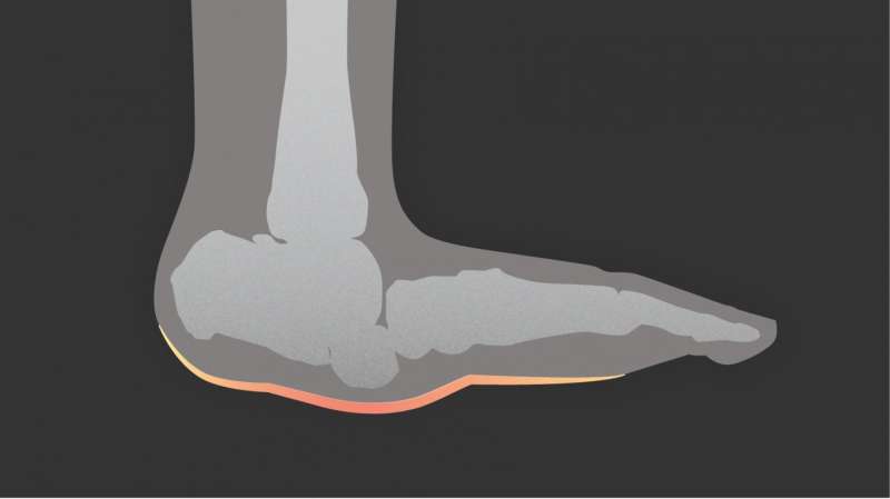 Study: Two-thirds of clinicians lack knowledge of diabetes-related foot complication
