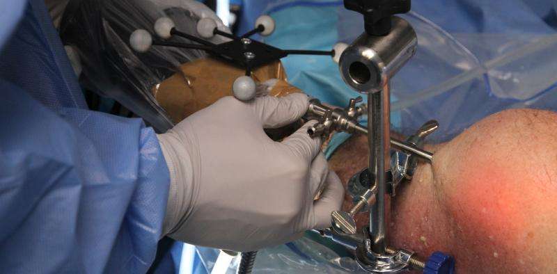 外科医生承认手术中的错误，如果他们减少了风险，就会使用机器人